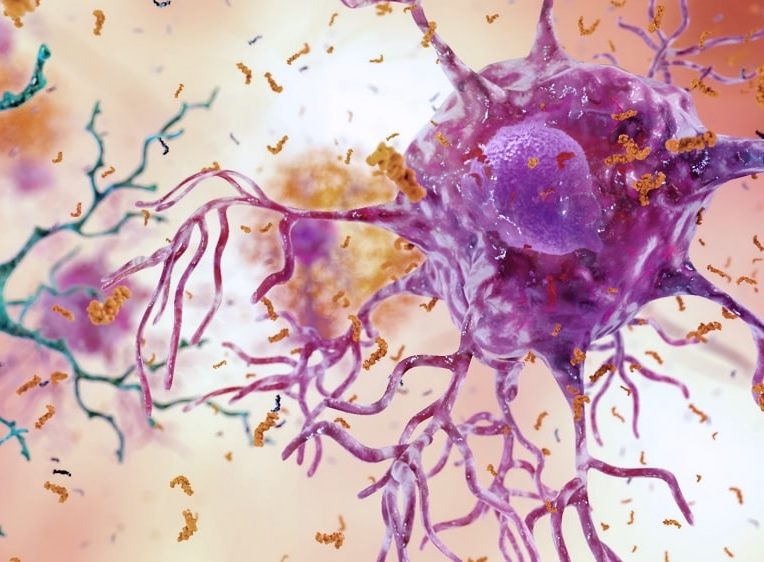 chercheurs identifient neurones vulnerables maladie alzheimer