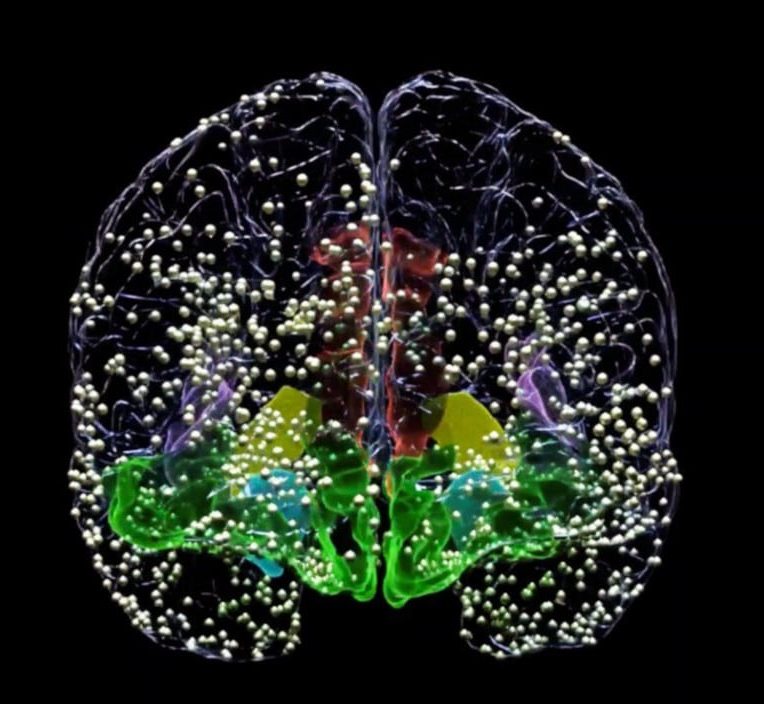 stimulation ciblée traitement dépression