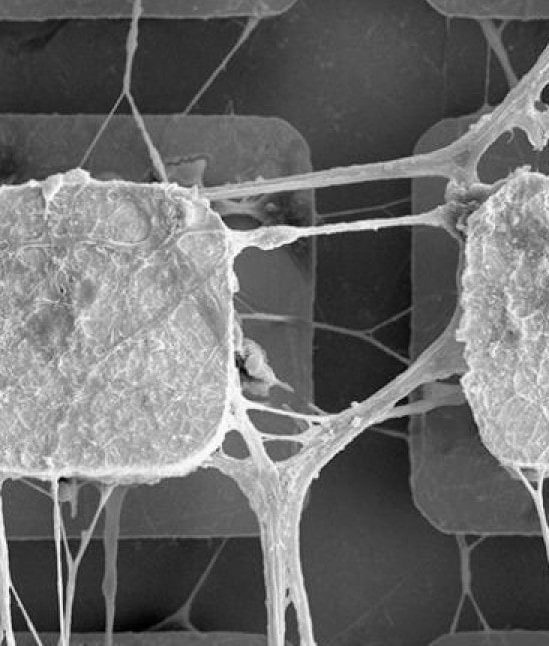 cellules cerveau puces électroniques IA