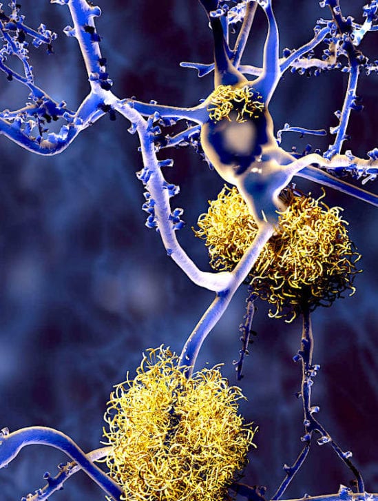 cbd reduirait plaques-beta amyloides ameliorerait cognition alzheimer