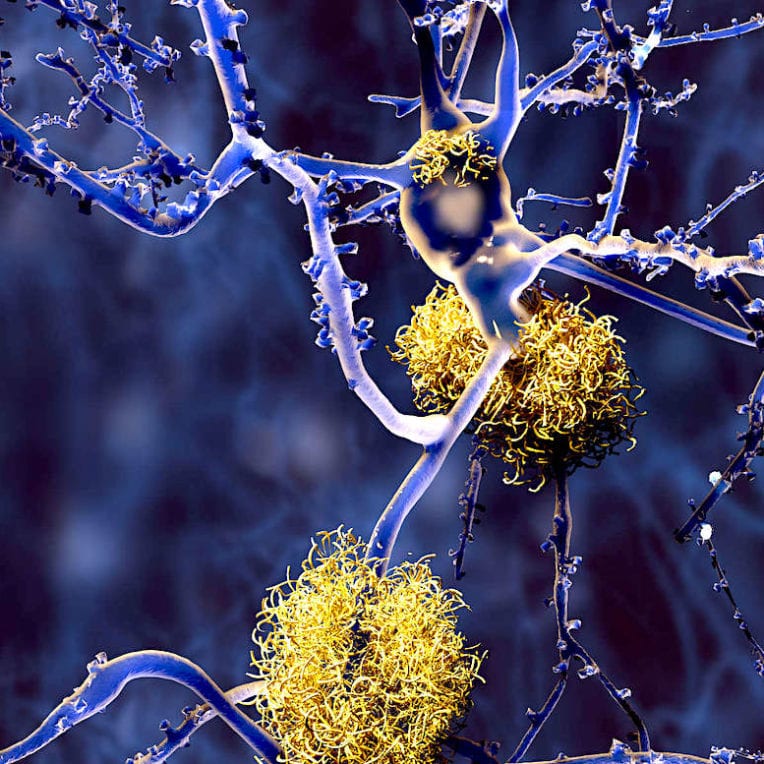 cbd reduirait plaques-beta amyloides ameliorerait cognition alzheimer
