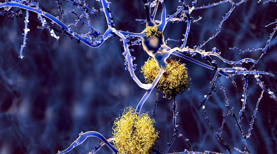 cbd reduirait plaques-beta amyloides ameliorerait cognition alzheimer