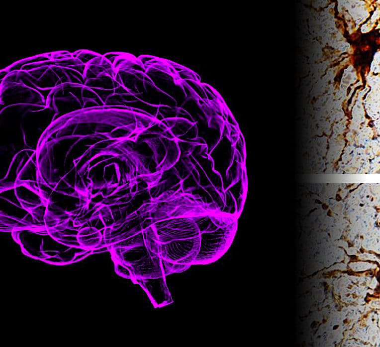 etude montre certains genes reprennent vie dans cerveau apres mort