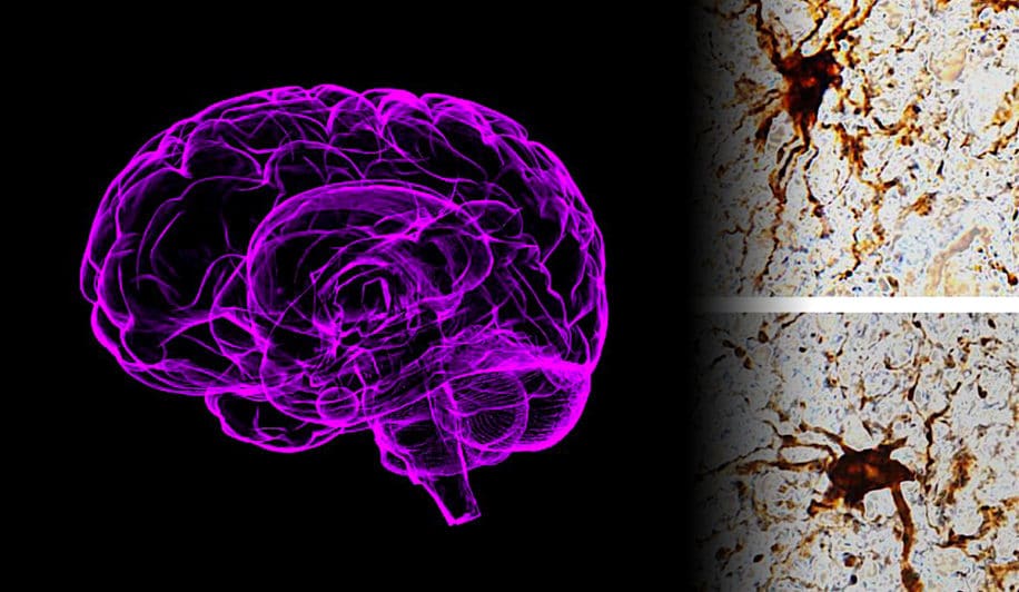 etude montre certains genes reprennent vie dans cerveau apres mort