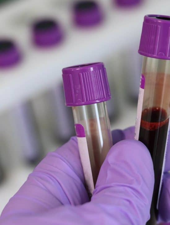 analyse sang diagnostic dépression