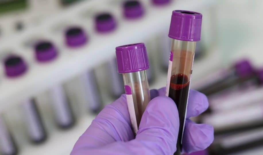 analyse sang diagnostic dépression