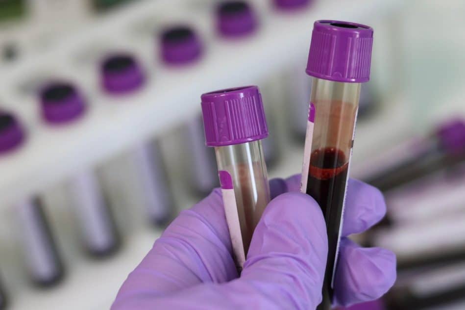 analyse sang diagnostic dépression