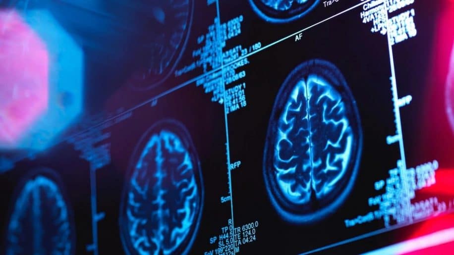 canada medecins enquetent mysterieuse maladie neurologique couv
