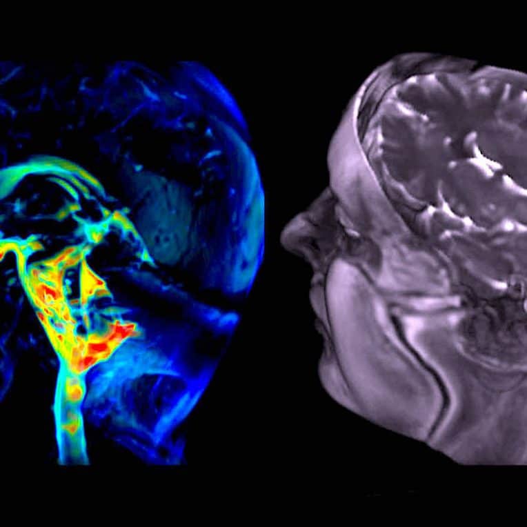 nouvelle technique imagerie capture mouvement cerebral avec precision etonnante