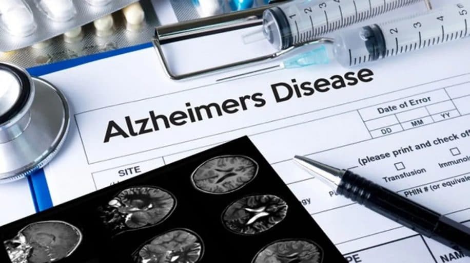 alzheimer vaccin passe succes essais cliniques phase 2