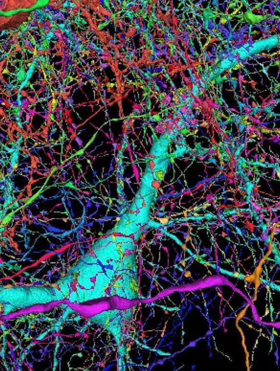 google cartographie echantillon cerveau humain comme jamais auparavant