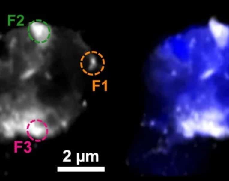 métaux cerveau alzheimer