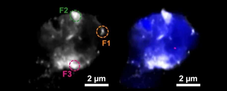 métaux cerveau alzheimer