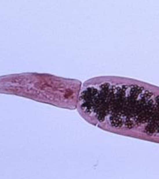 parasite ténia épidémie