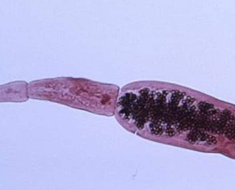 parasite ténia épidémie