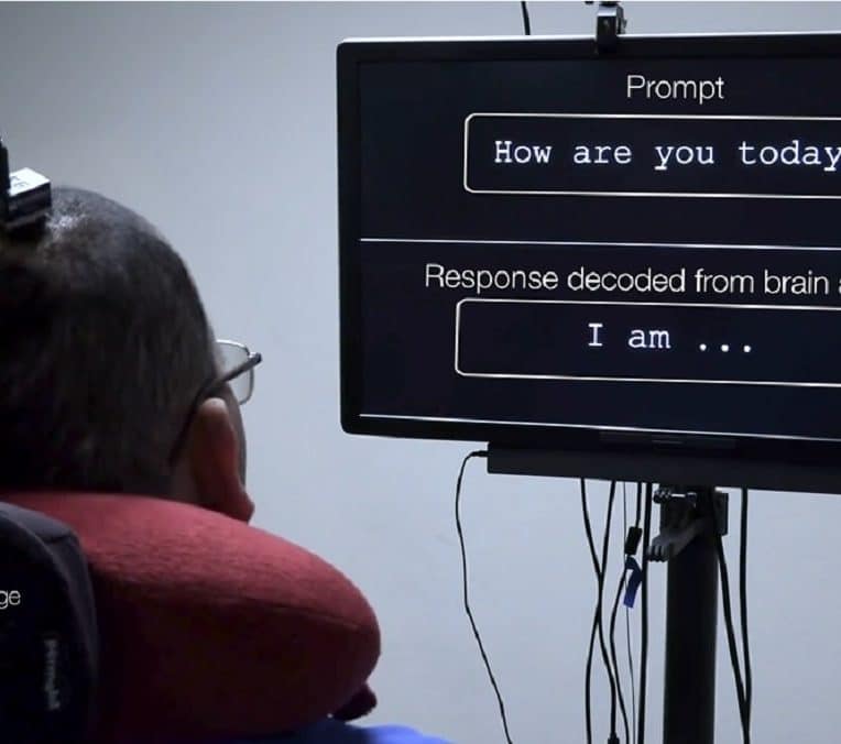 activite cerebrale patient paralyse convertie texte