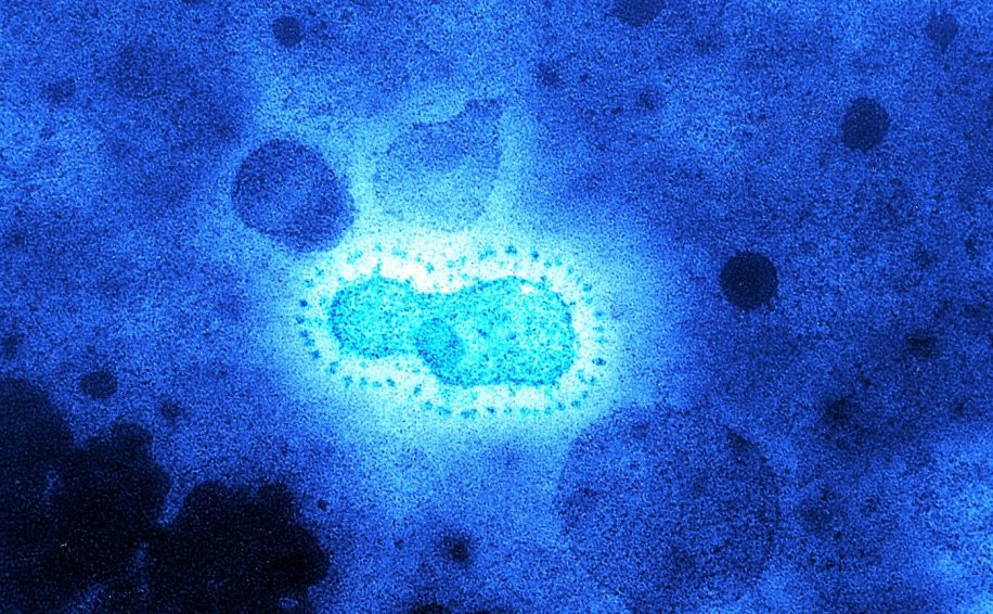 virus inconnus vieux 15 000 ans decouverts glacier tibetain