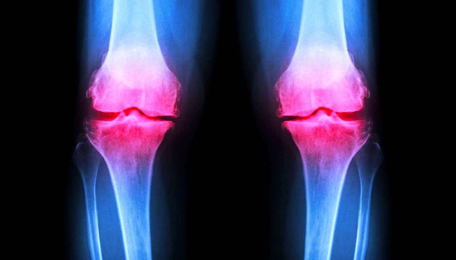 hydrogel injectable regenerer cartilage endommage articulations
