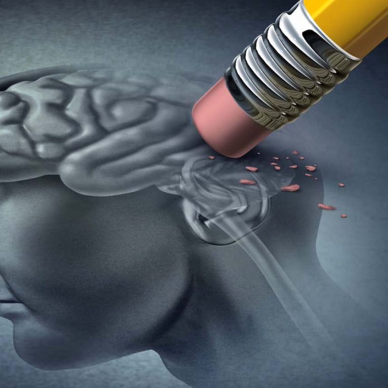 nouvelle etude identifie cause probable maladie alzheimer