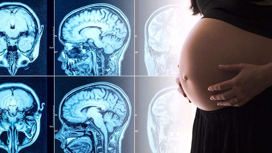 chances tomber enceinte reduites 2 ans apres commotion cerebrale