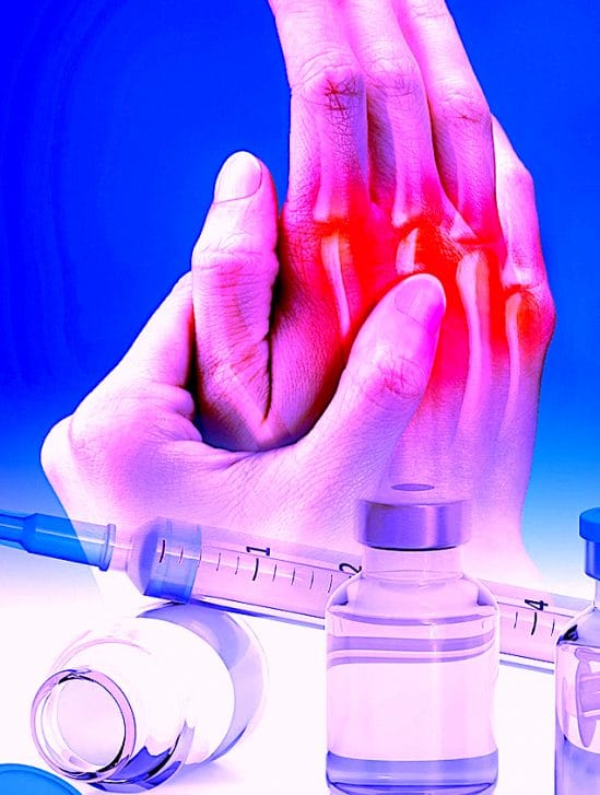 chercheurs ont mis au point vaccin revolutionnaire contre polyarthrite rhumatoide