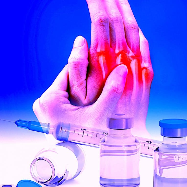chercheurs ont mis au point vaccin revolutionnaire contre polyarthrite rhumatoide