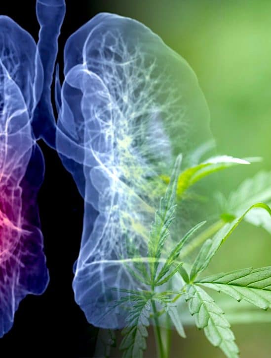 femme taille tumeur regresse avec consommation cbd