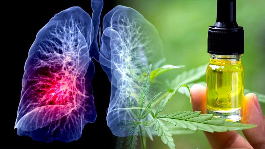 femme taille tumeur regresse avec consommation cbd