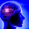 implant cerebral personnalise utilise avec succes traitement depression