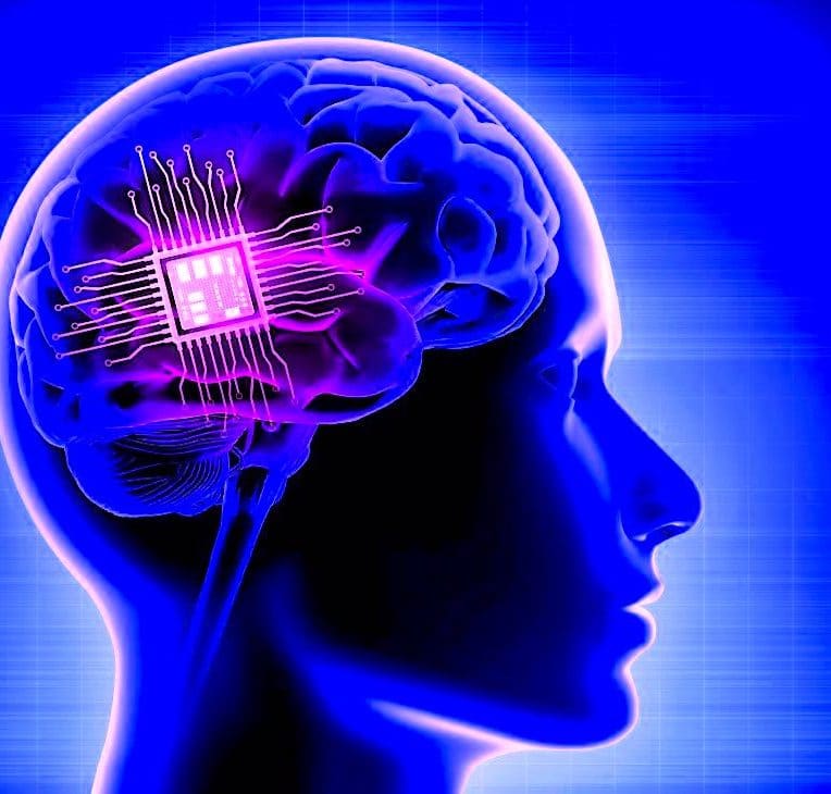 implant cerebral personnalise utilise avec succes traitement depression