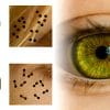 pupille reagit informations numeriques etude