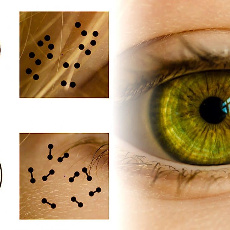 pupille reagit informations numeriques etude