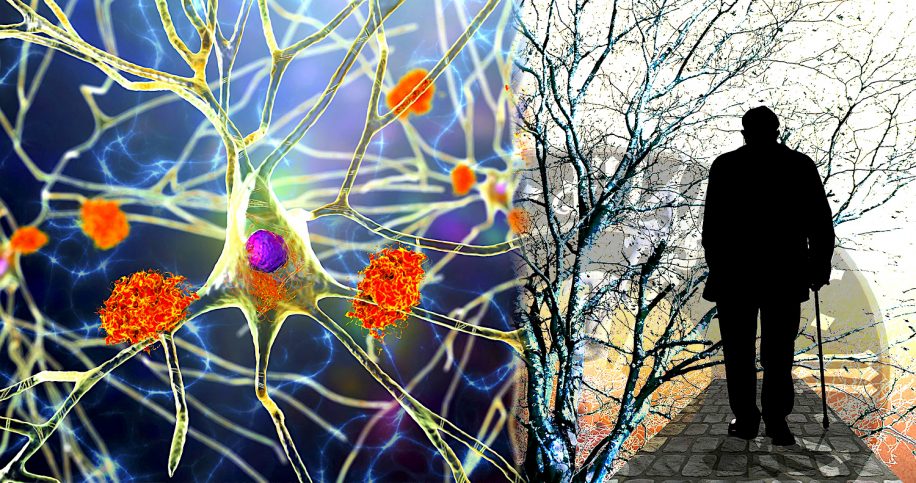 cause progression agressive alzheimer identifiee