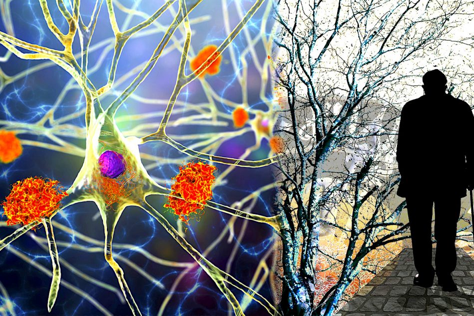 cause progression agressive alzheimer identifiee