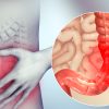 facteurs genetiques syndrome intestin irritable