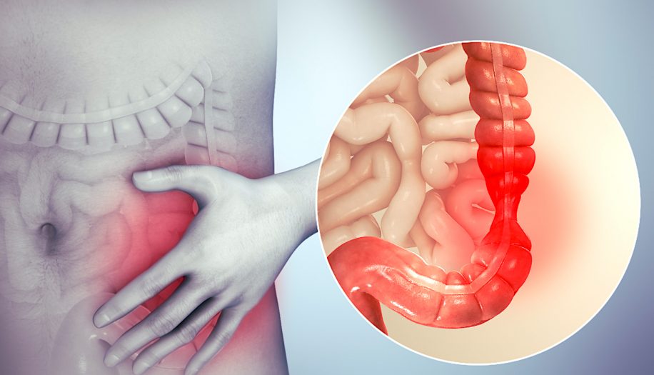 facteurs genetiques syndrome intestin irritable