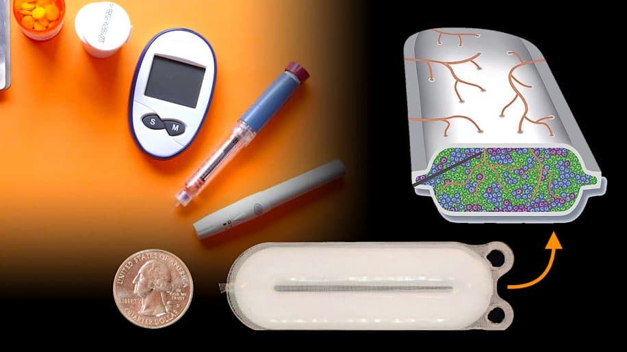 diabete type 1 nouveau traitement secreteur insuline
