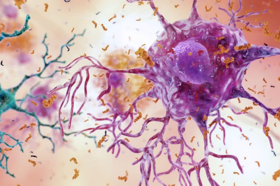 traitement cellules immunitaires cerveau alzheimer