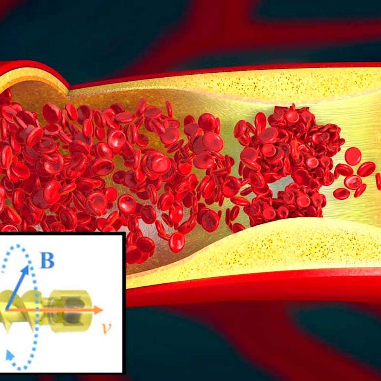 microrobot helicoidal nage dans vaisseaux sanguins pour nettoyer