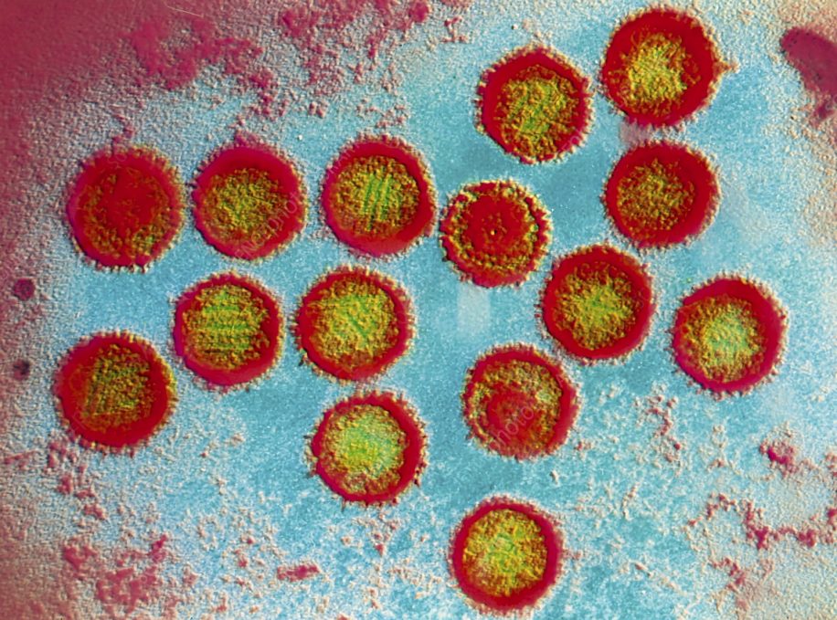 sclerose en plaques virus epstein barr serait cause principale