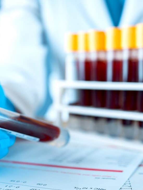 test sanguin detection cancer precocement