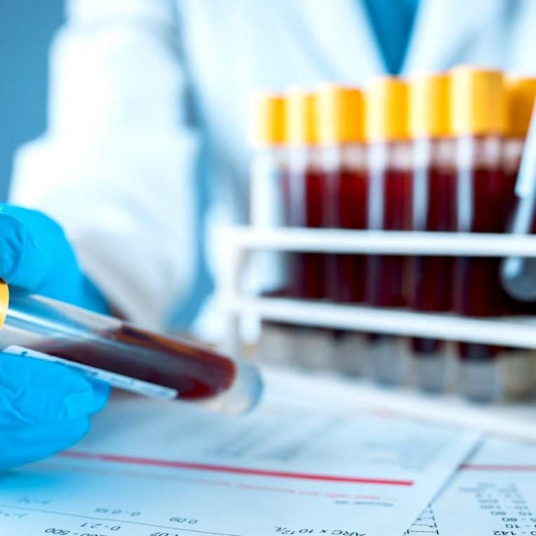 test sanguin detection cancer precocement