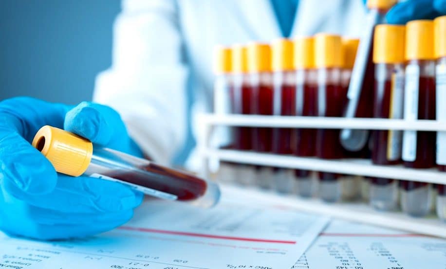 test sanguin detection cancer precocement