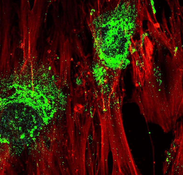 Onde sonore cellules souches cellules osseuses