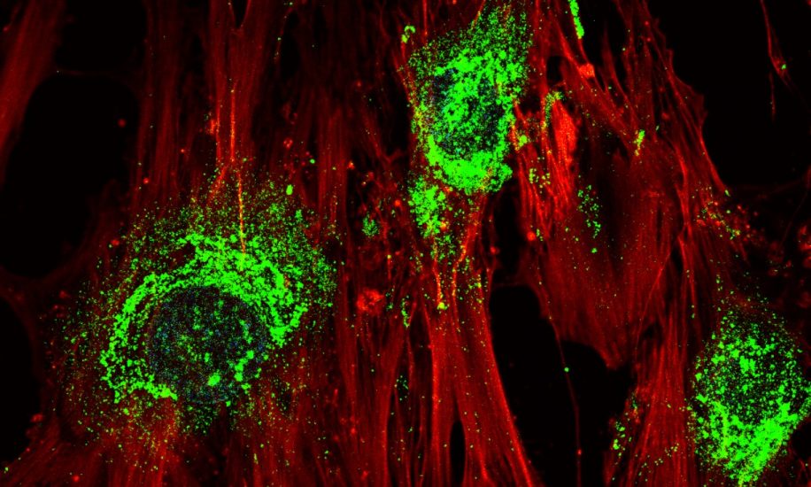 Onde sonore cellules souches cellules osseuses