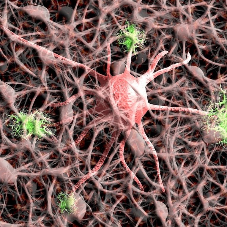covid changements moleculaires lies alzheimer detectes cerveau patients