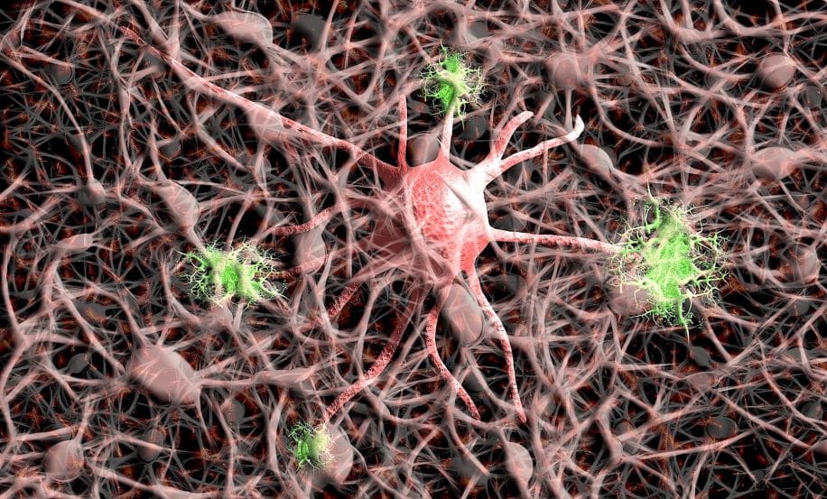 covid changements moleculaires lies alzheimer detectes cerveau patients