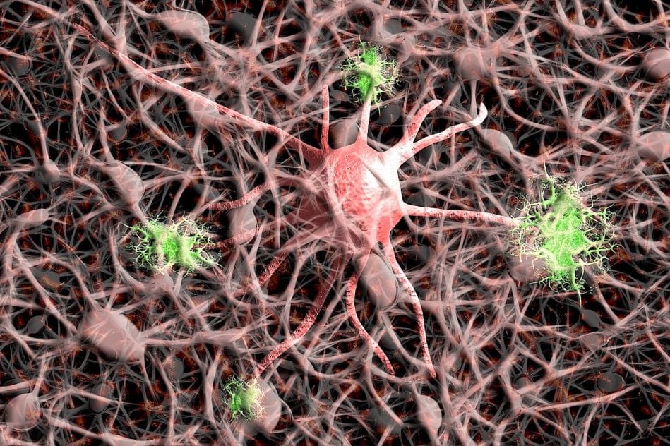 covid changements moleculaires lies alzheimer detectes cerveau patients