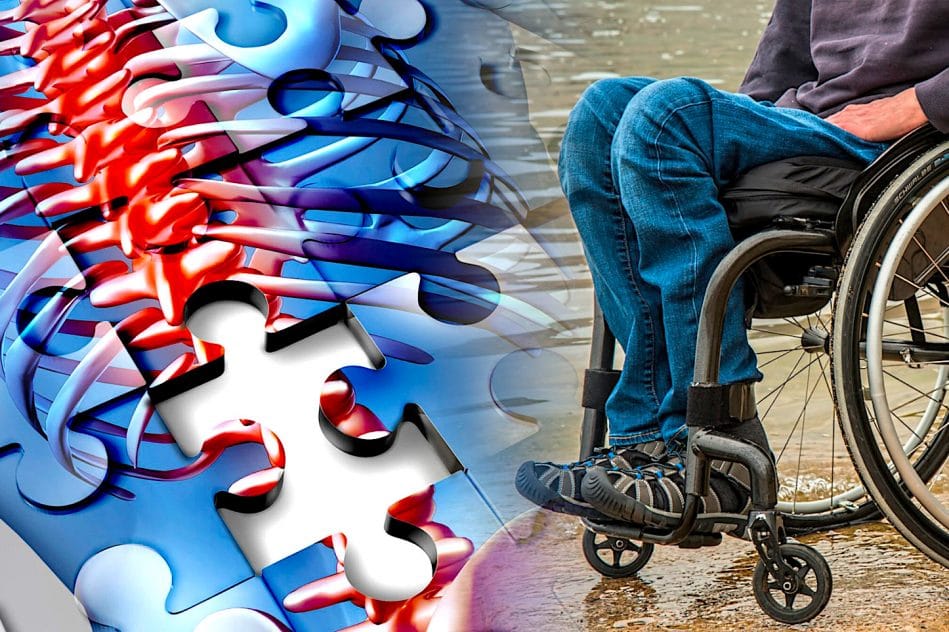 traitement paralysie implants moelle épinière