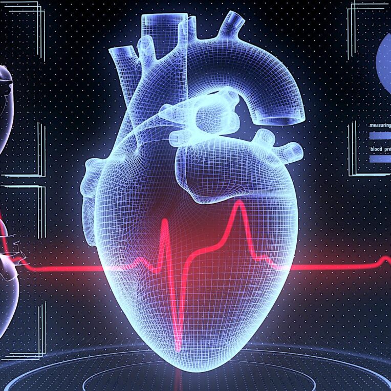 algorithme IA prédiction infarctus